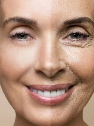 Aging