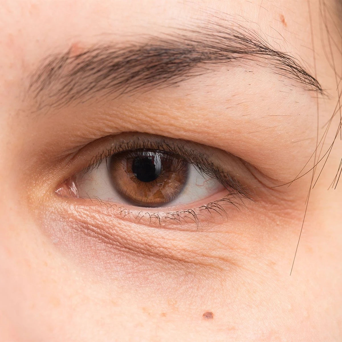 Dark Circles
