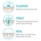 CeraVe Acne Foaming Cream Cleanser 4%