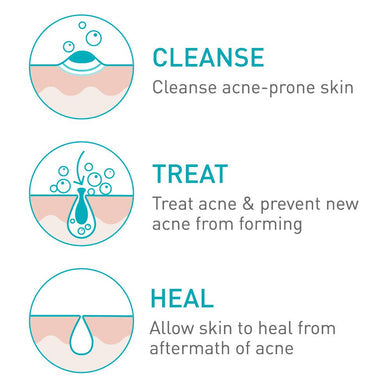 CeraVe Acne Foaming Cream Cleanser 4%